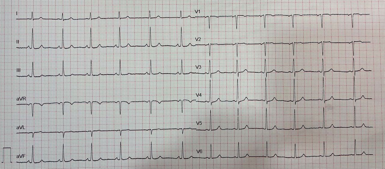 Salvatore Chianese-1