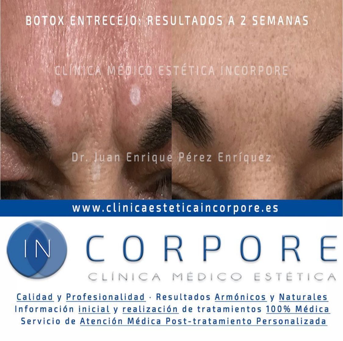 Juan Enrique Pérez Enríquez-61