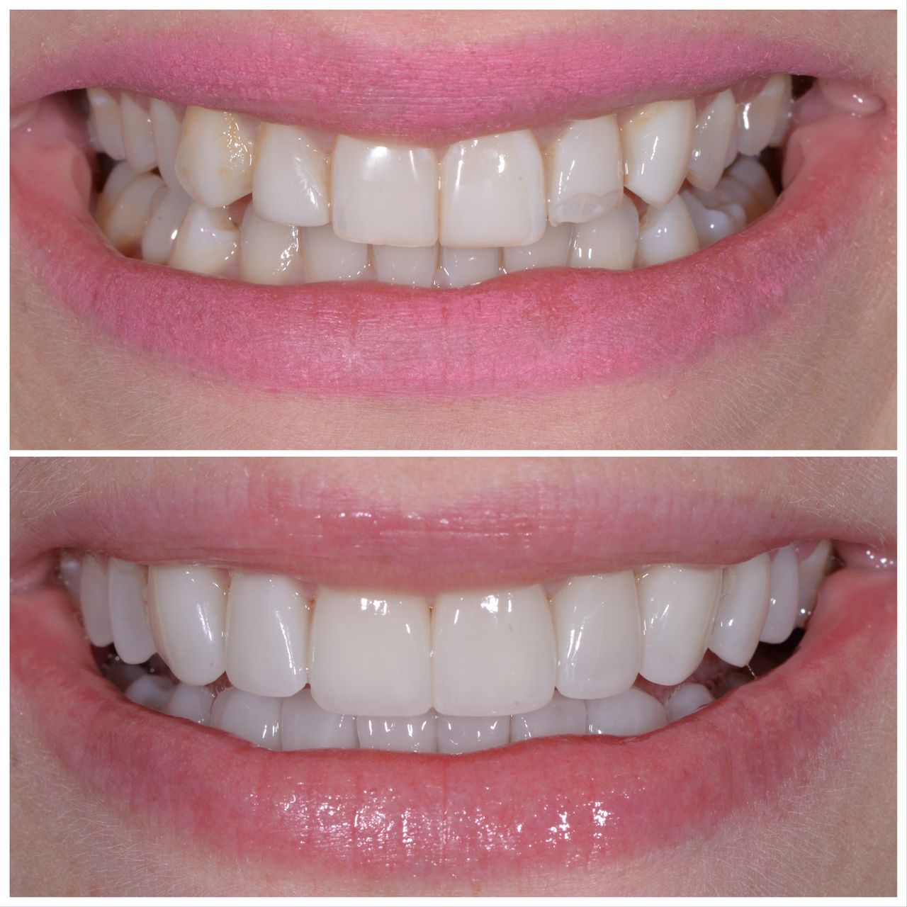 Martin Bartoszcze-40