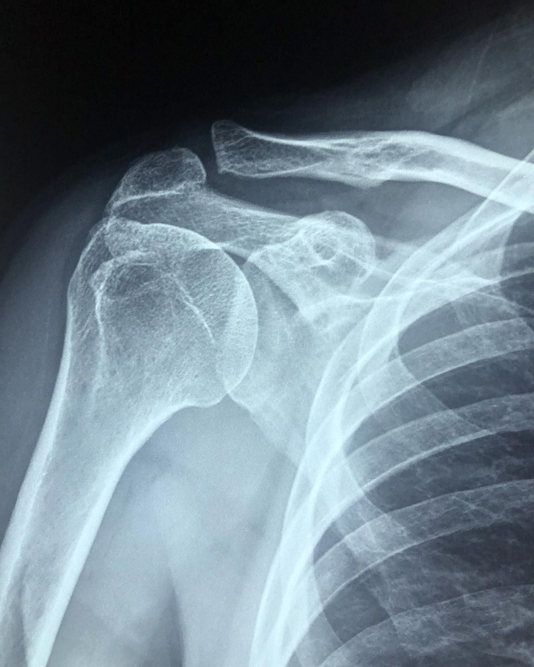 Giovanni Pelliccia-3