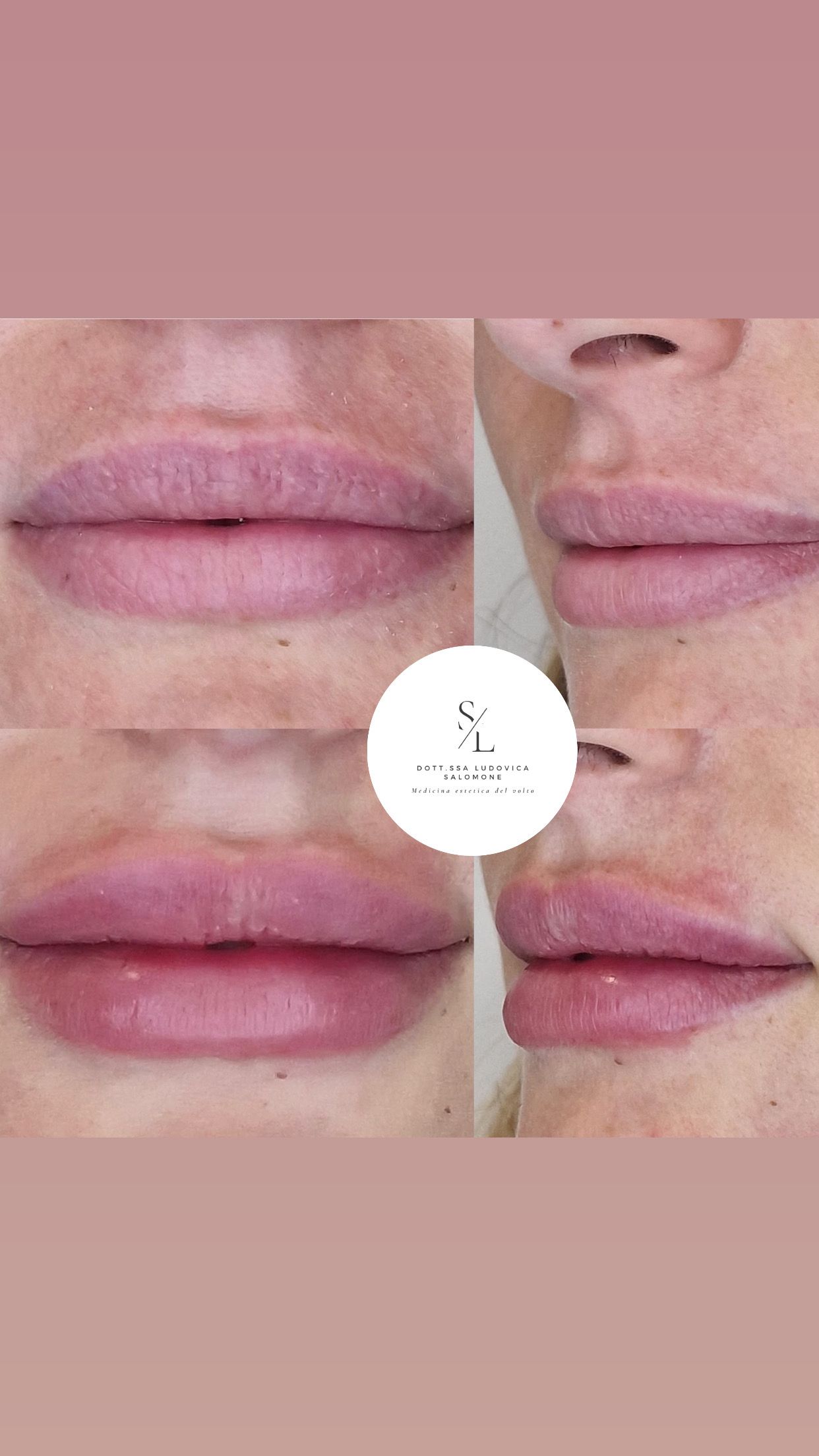 Ludovica Salomone-14