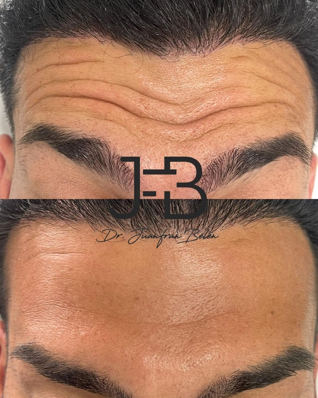 Juan Francisco Belén Montero-25