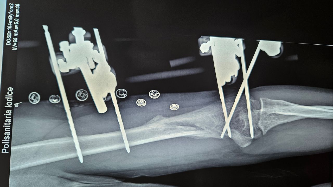 Gennaro Campopiano-12