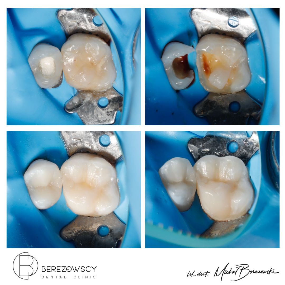 Michał Berezowski-52