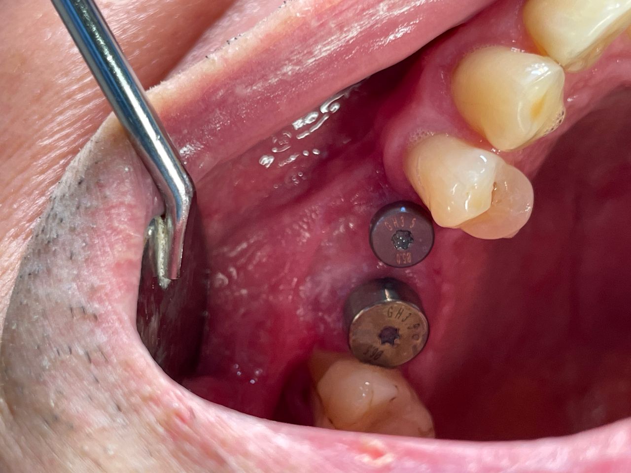 Cezary Pogorzelski-20