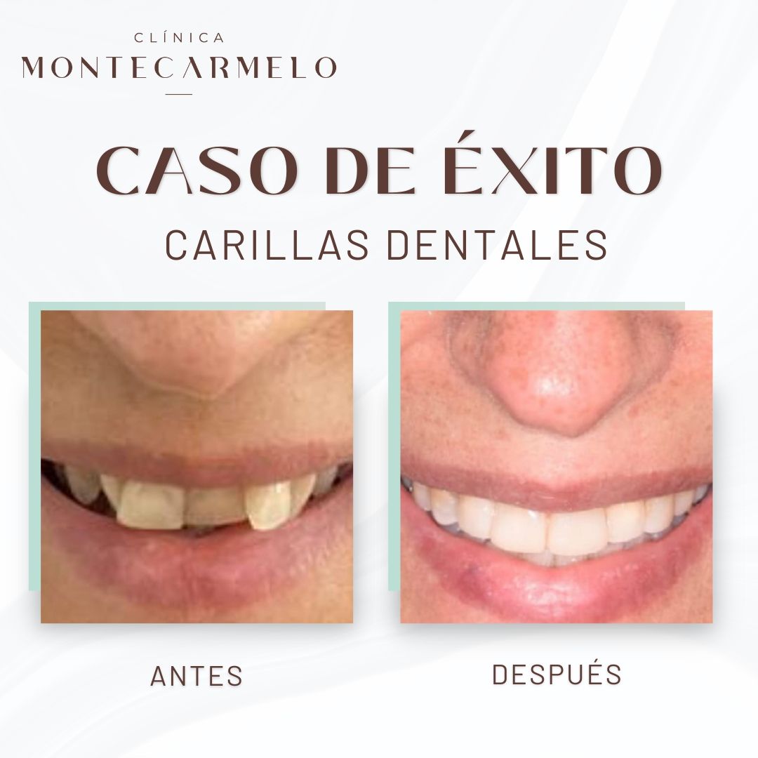 Raúl Cobos Torrero-4