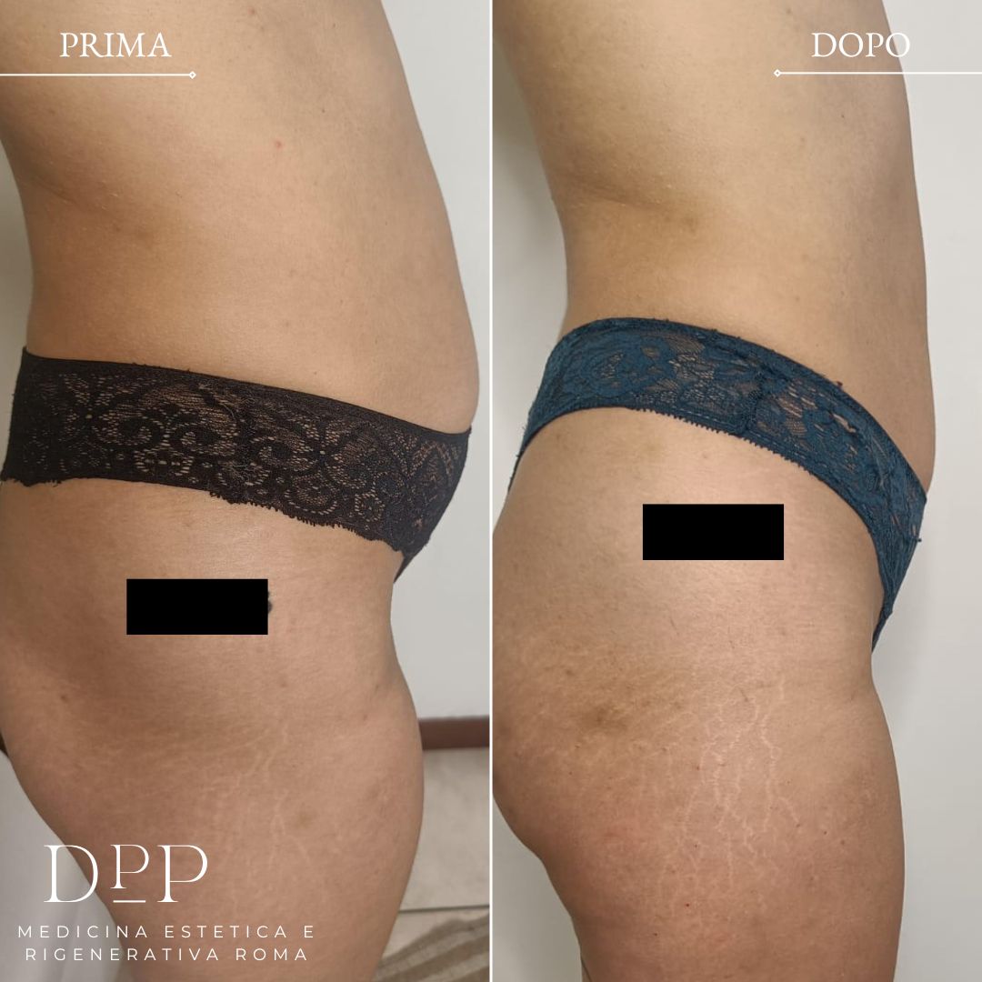 Davide Prosperi Porta-5