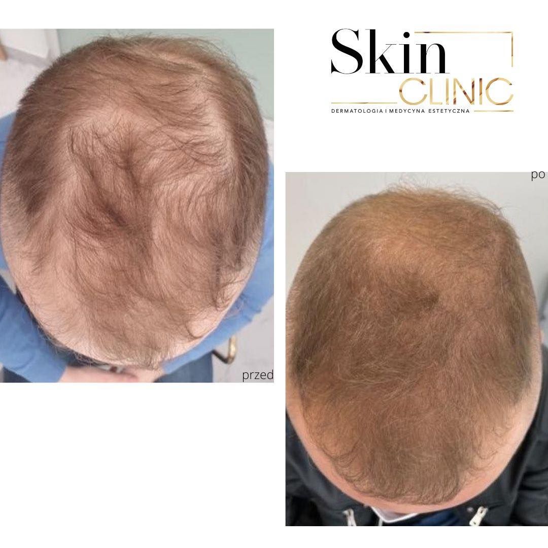 Alina Skrzypek-Salamon-7