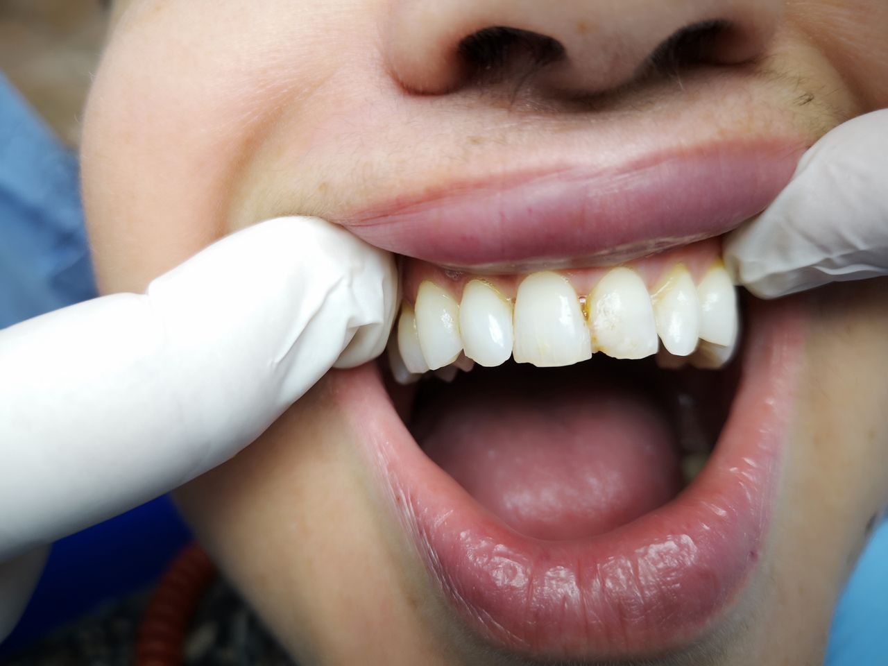 Stefano De Simone-74