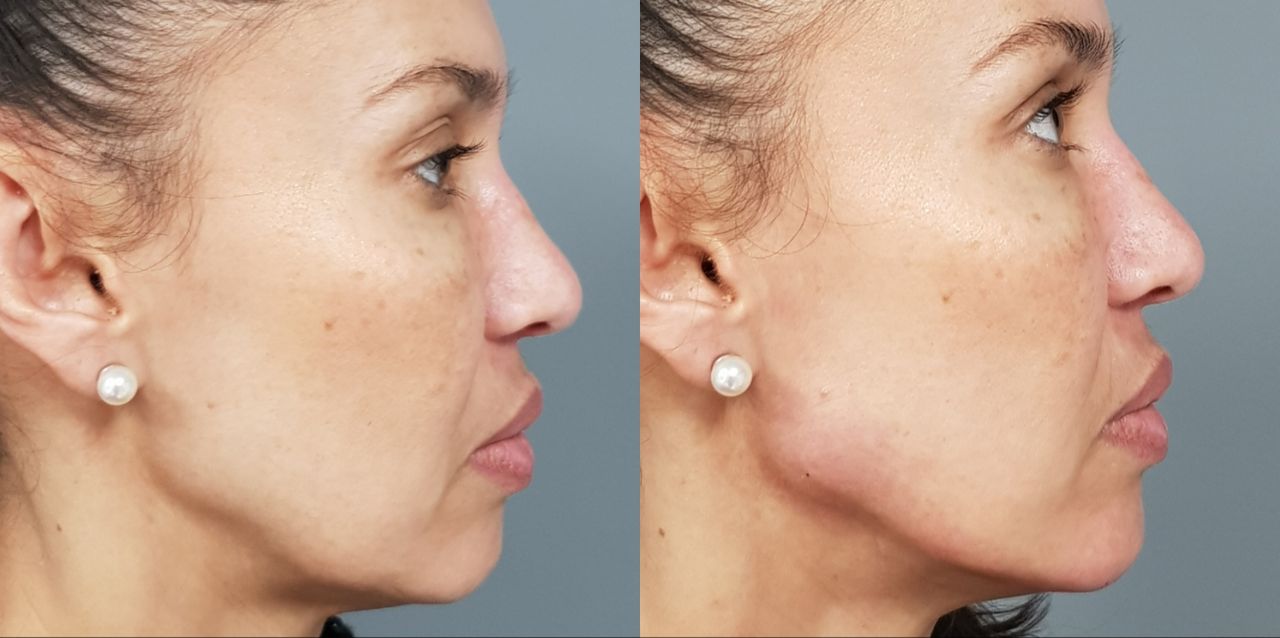 Rosalba Herrero Zerpa-66