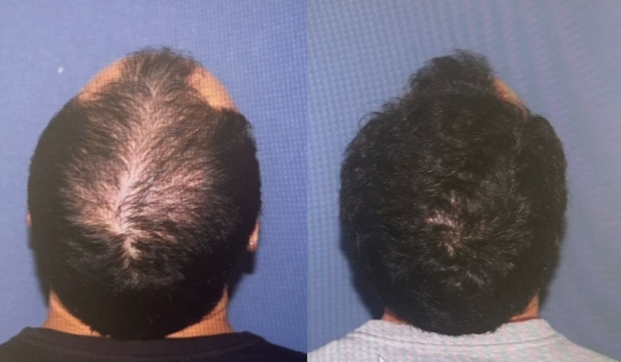 Manuel Ballesteros Redondo-0