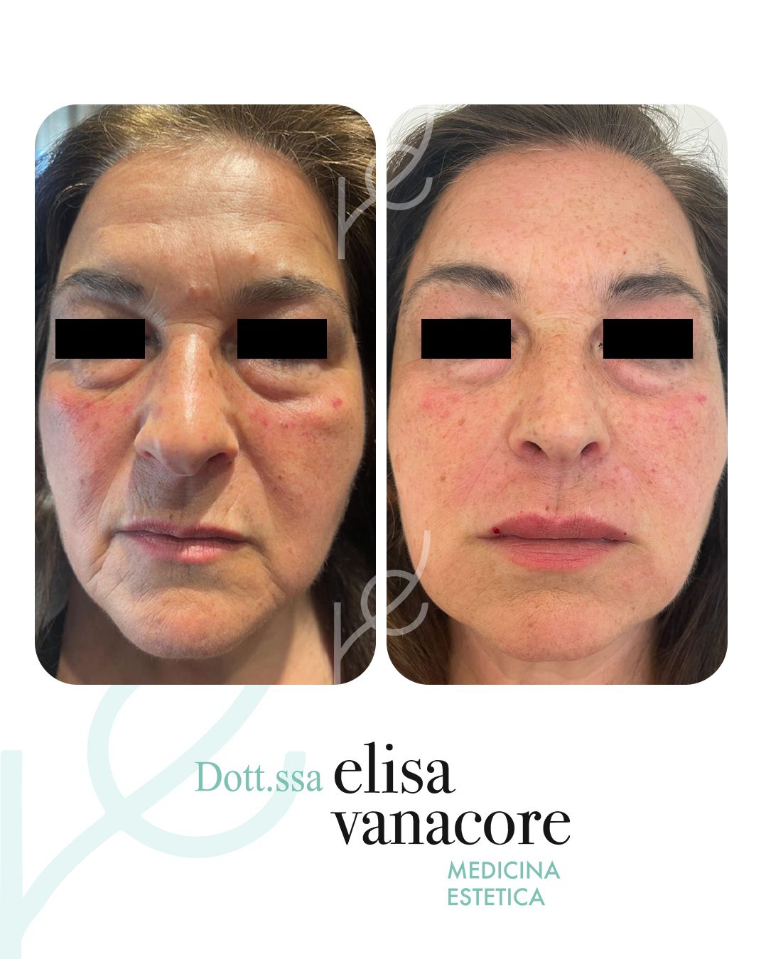 Elisa Vanacore-39