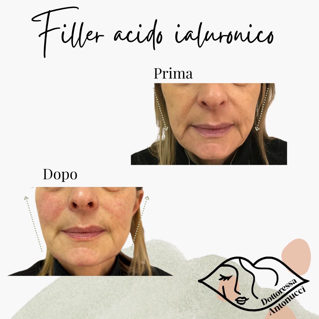 Maria Giordana Antonucci-6