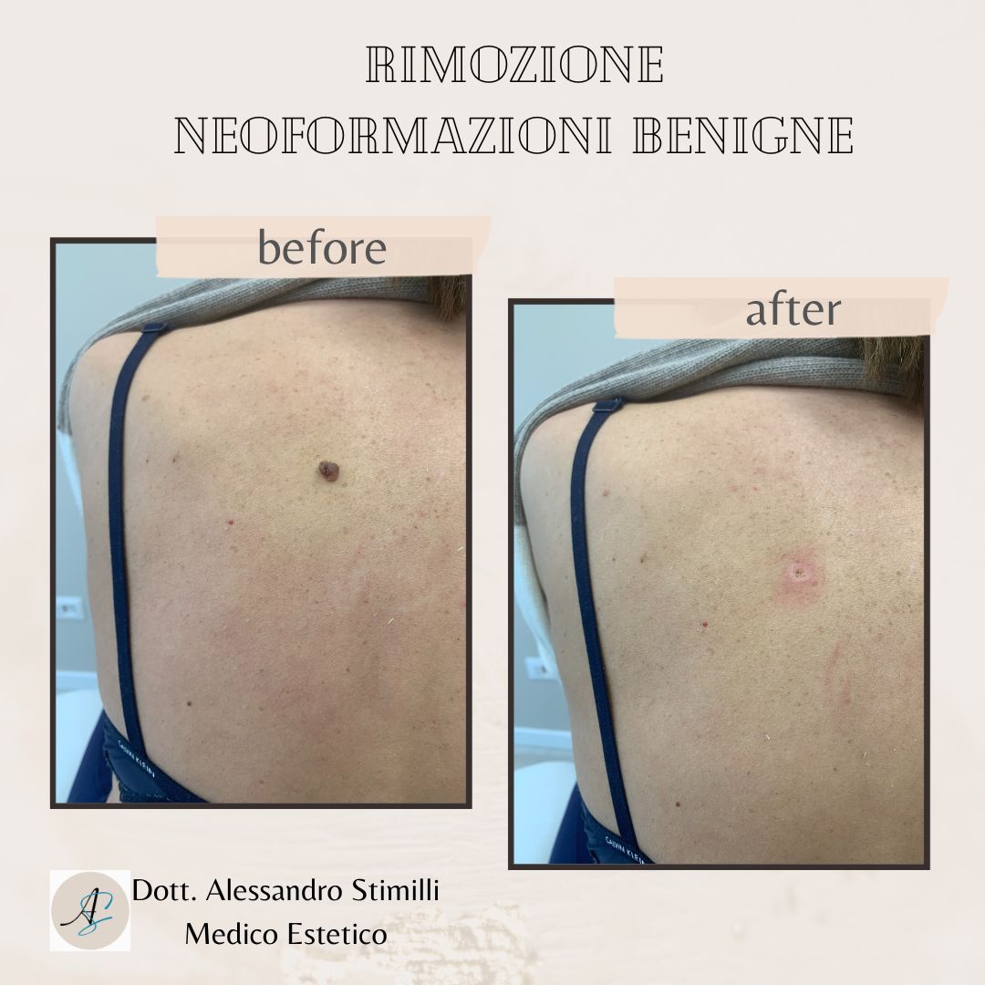 Alessandro Stimilli-15