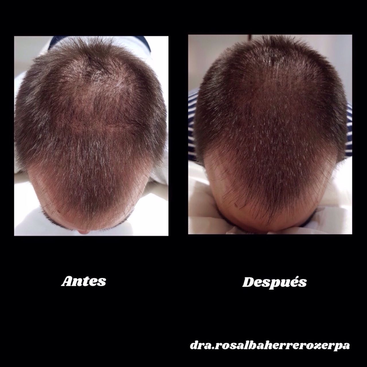 Rosalba Herrero Zerpa-363