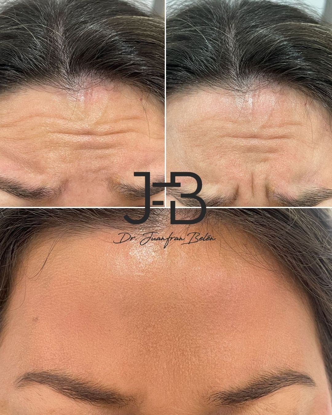 Juan Francisco Belén Montero-22