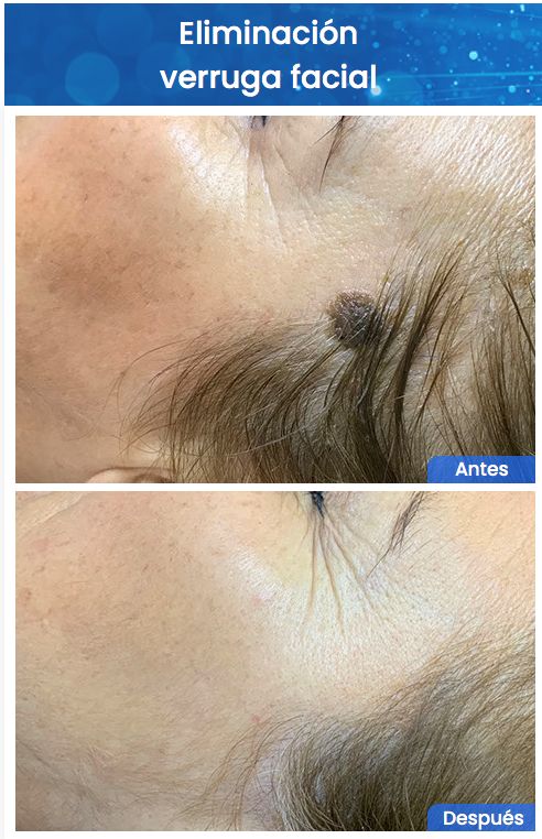 Juan Enrique Pérez Enríquez-133