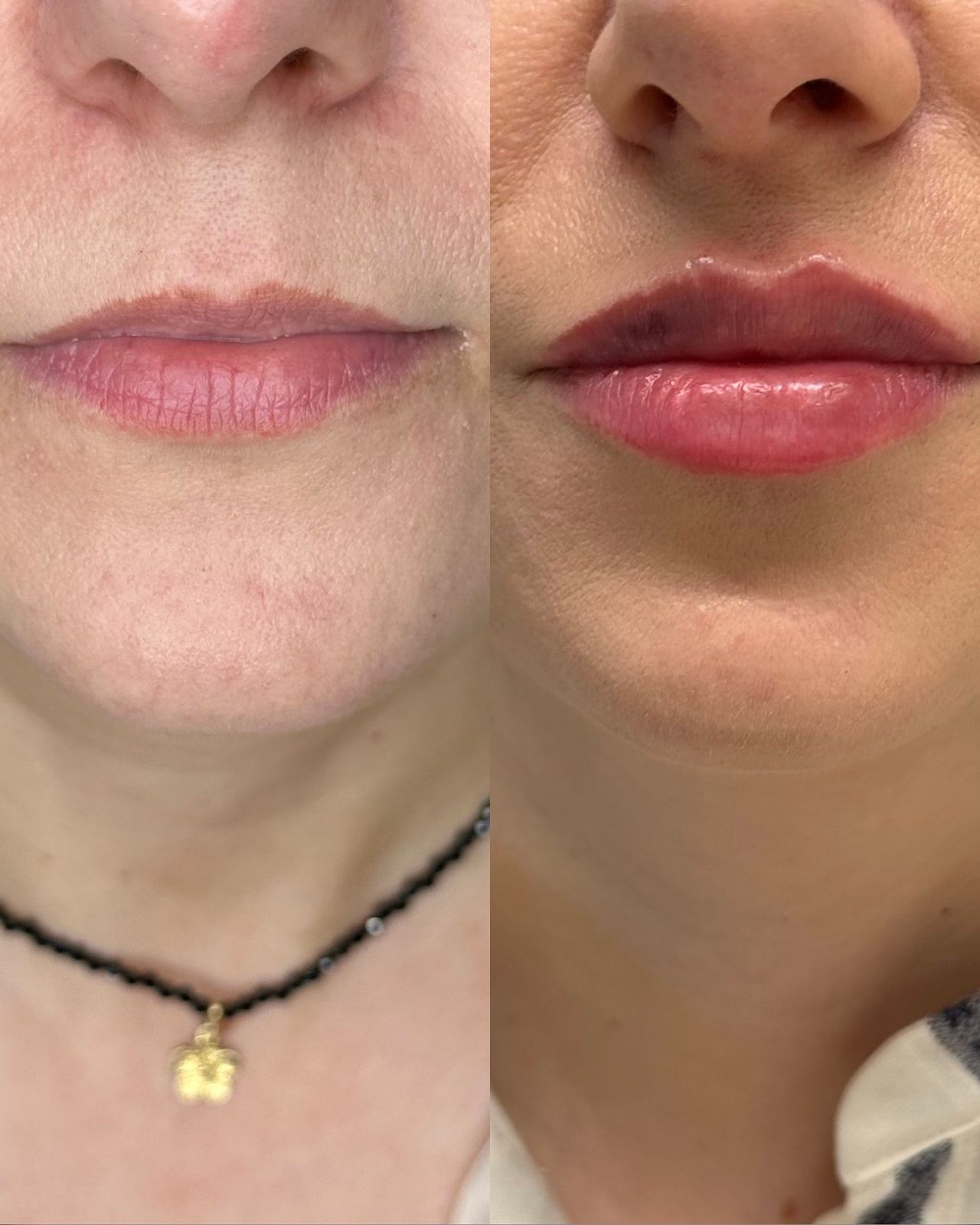 Michalina Zagańczyk-Bączek-42