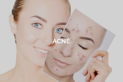 Raquel Moreno Pentinel-40