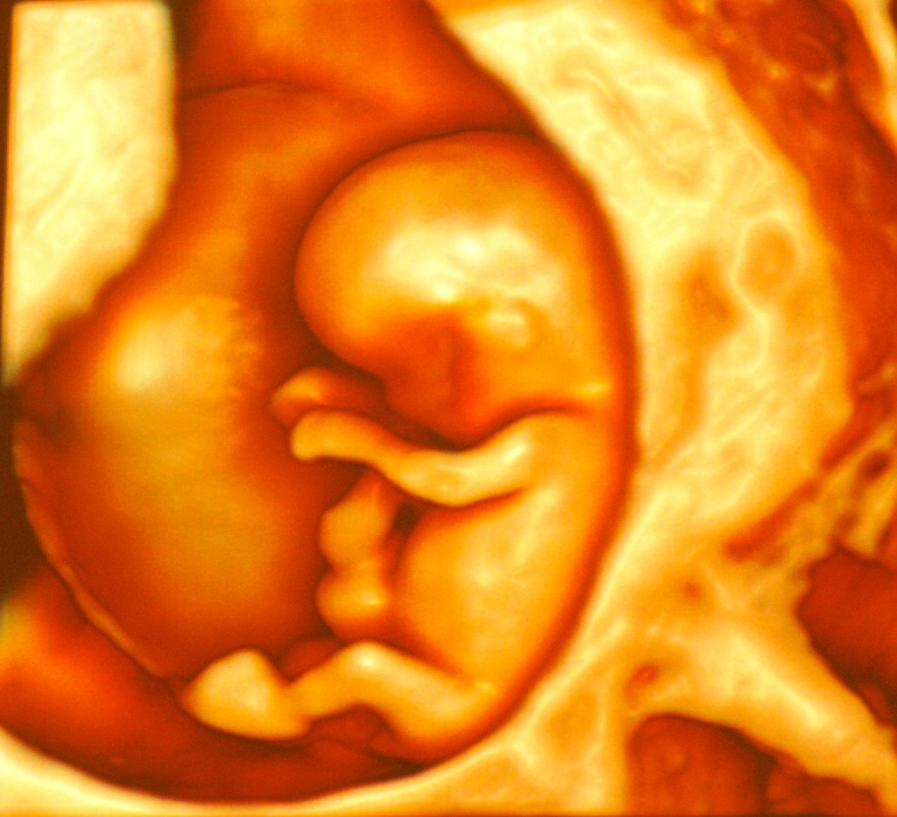 Antonio Claudio Cannizzaro-0