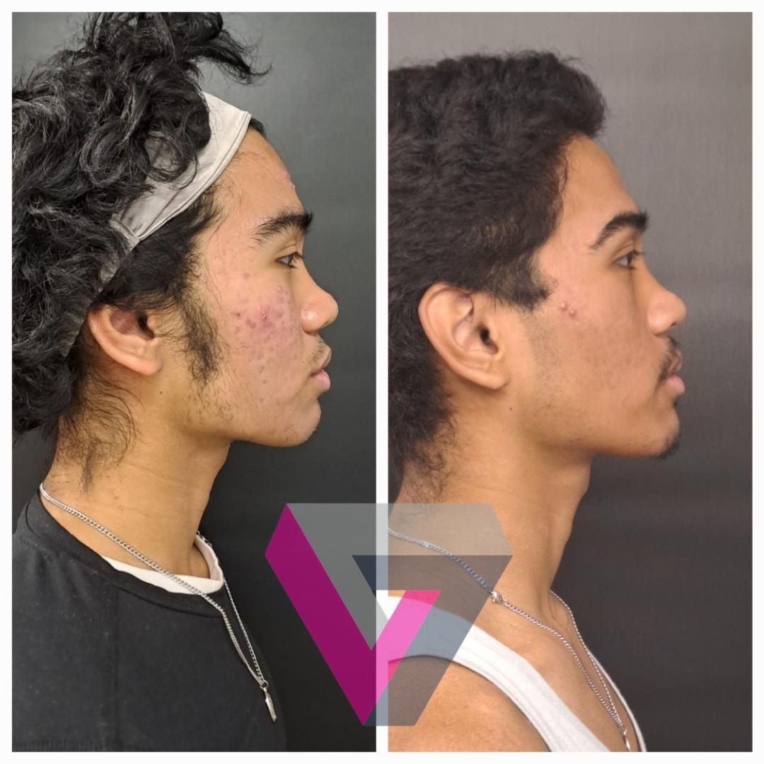 Victoria Trasmonte-114