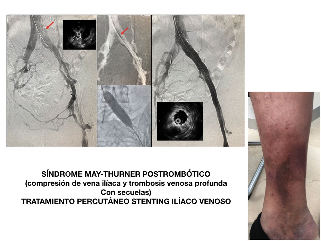 Maria Isabel Lara Guerrero-4