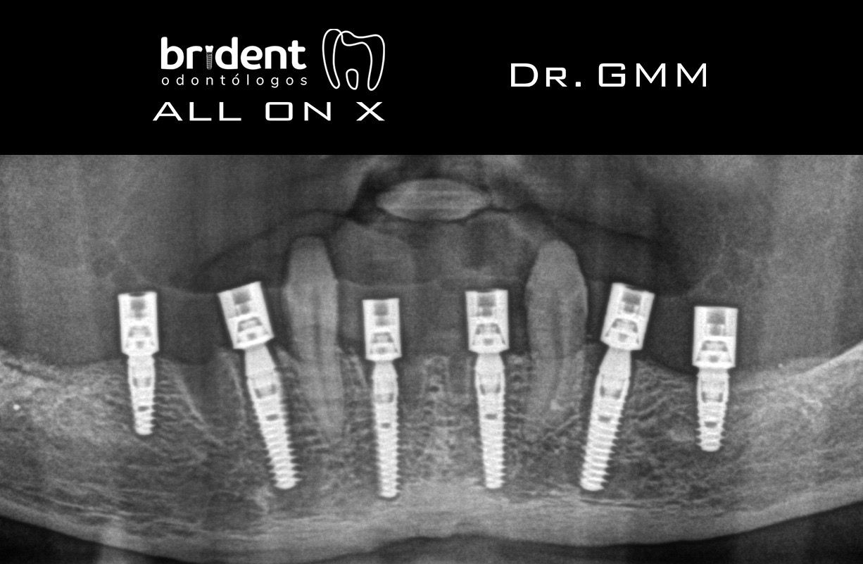 Guillermo Moreno Masiá-72