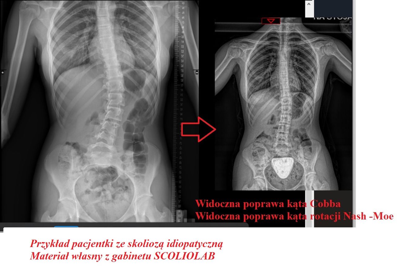 Patrycja Wilczyńska-2