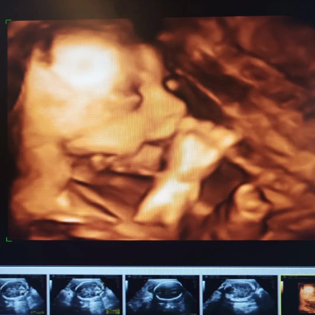 Medine Meltem Adalıoğlu-4