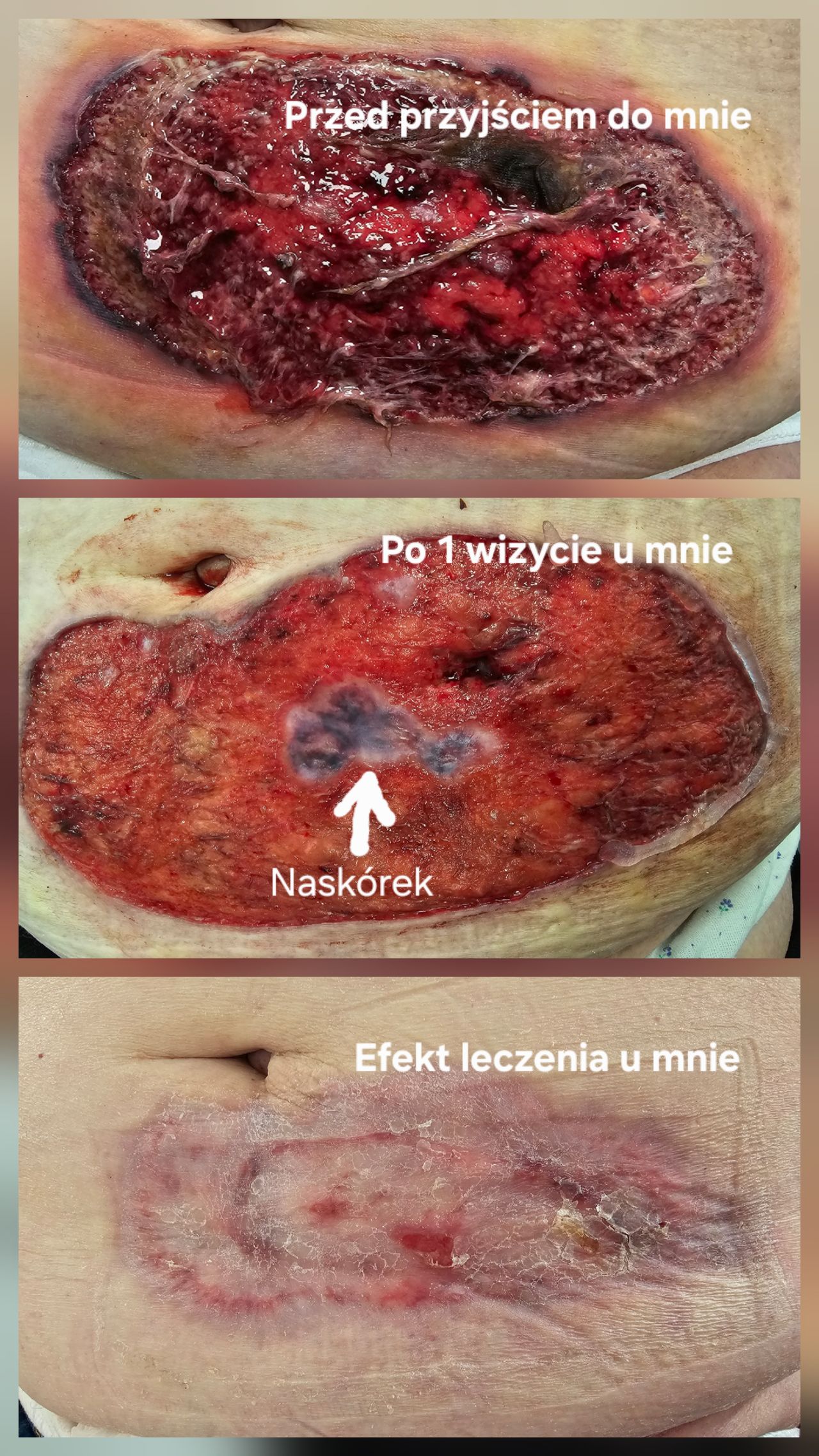 Bartłomiej  Staśkiewicz -10
