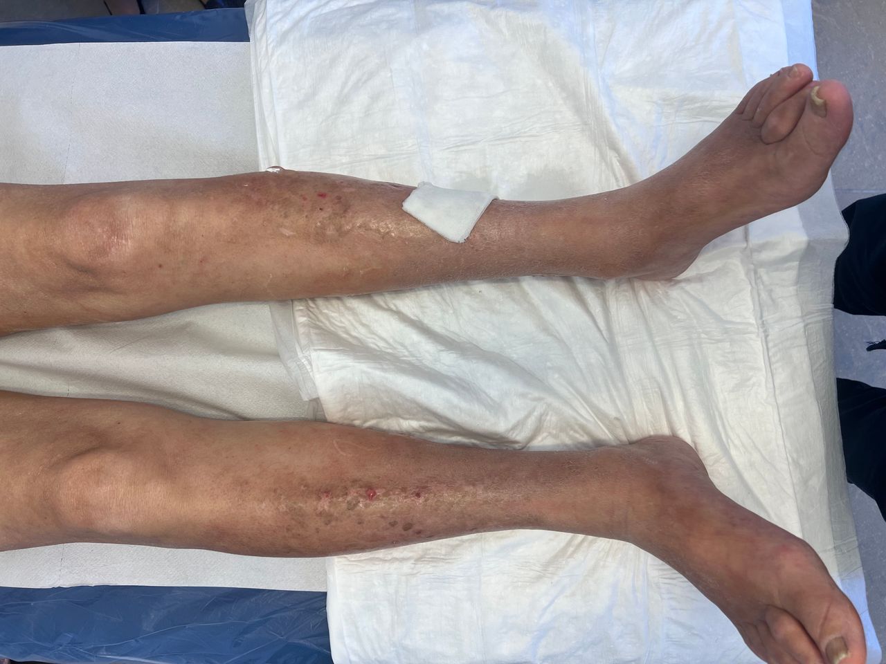 Luciano Allegretti-25