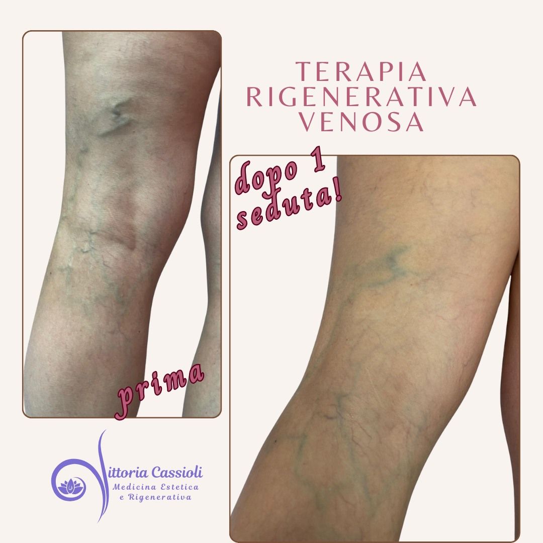 Vittoria Cassioli-45