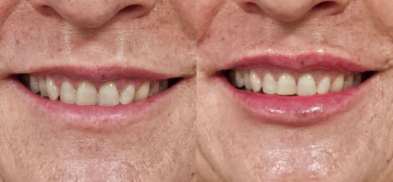 Rosalba Herrero Zerpa-435