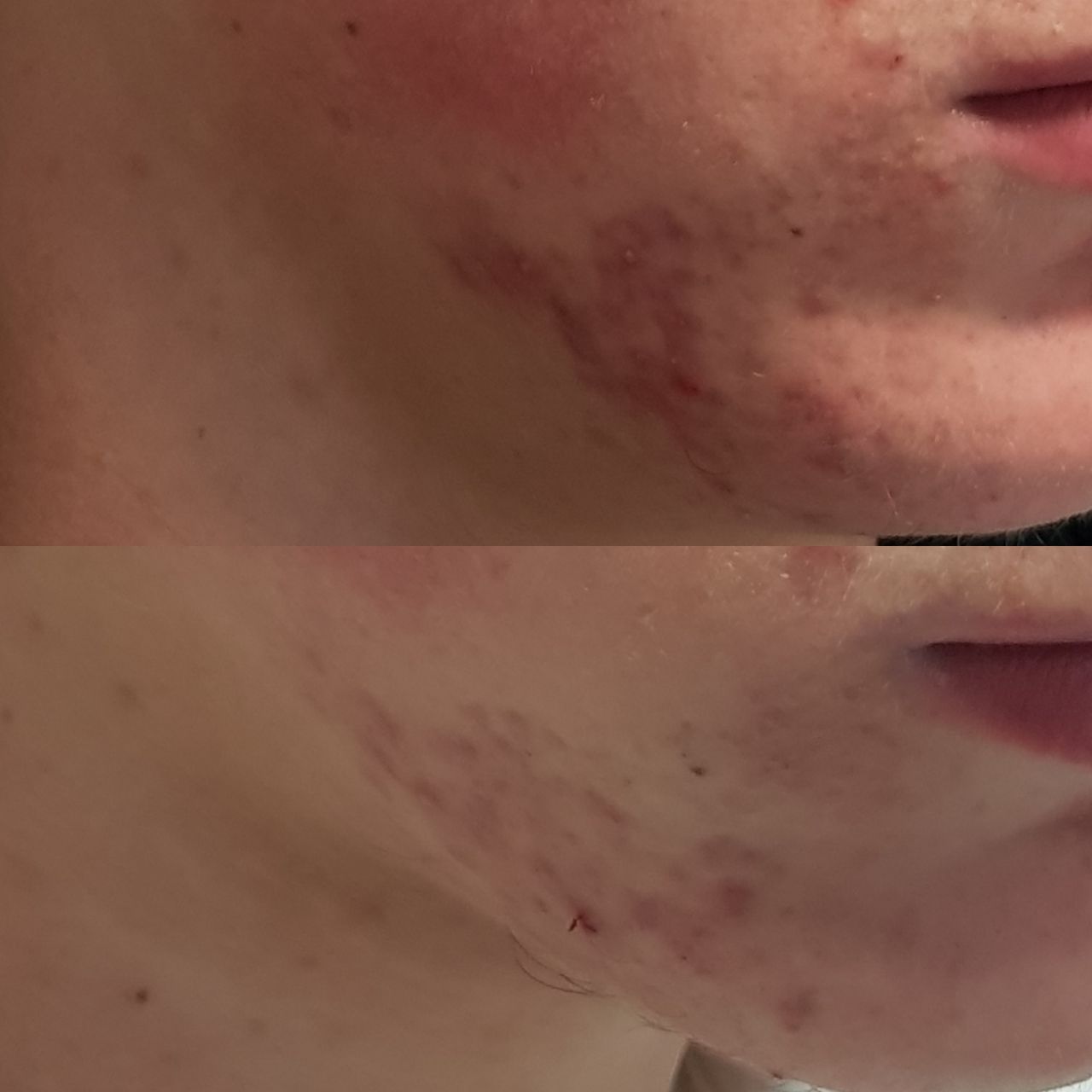 Rosalba Herrero Zerpa-288