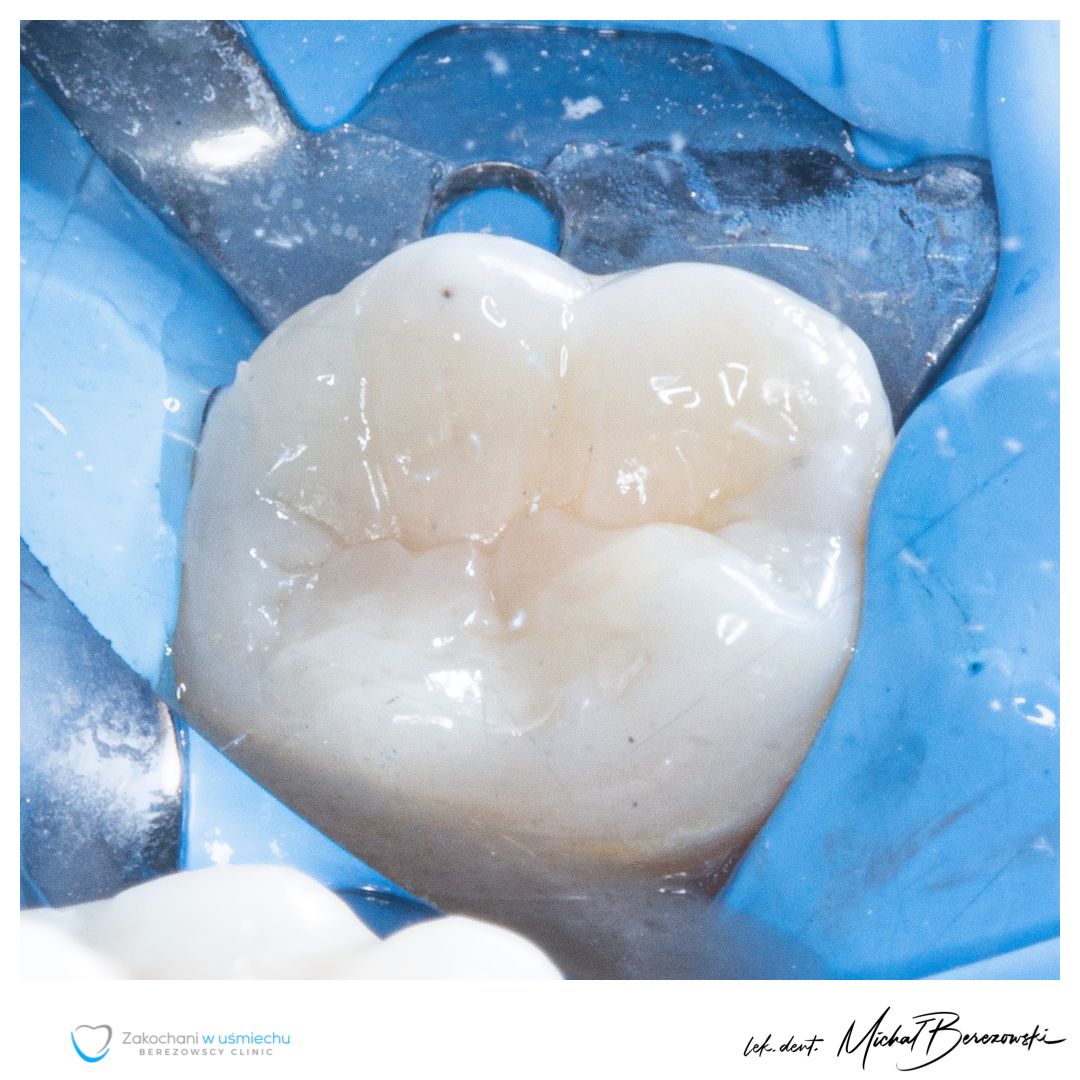 Michał Berezowski-5