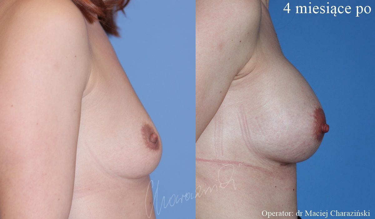 Maciej Charaziński-126