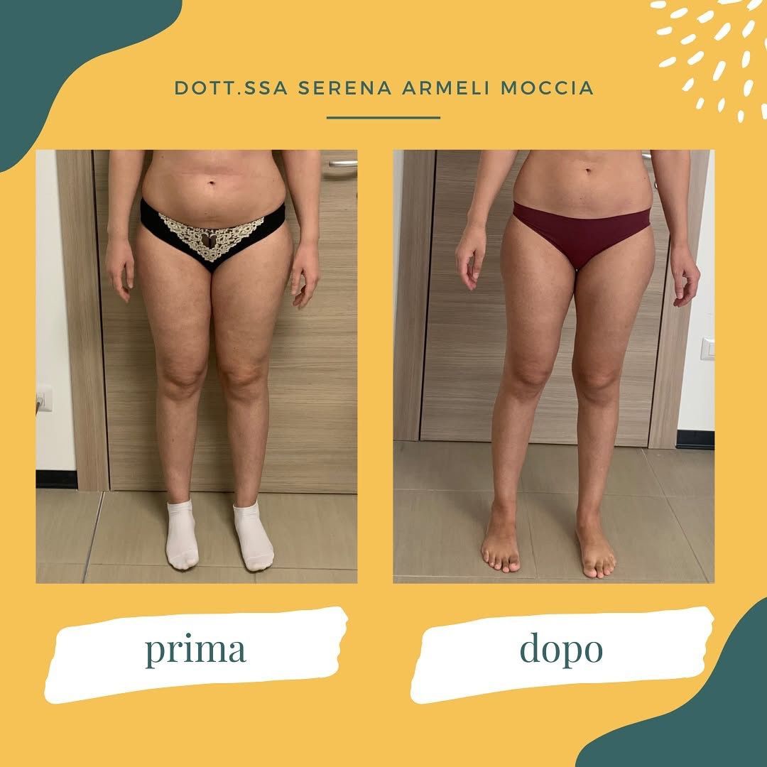 Serena Armeli Moccia-1