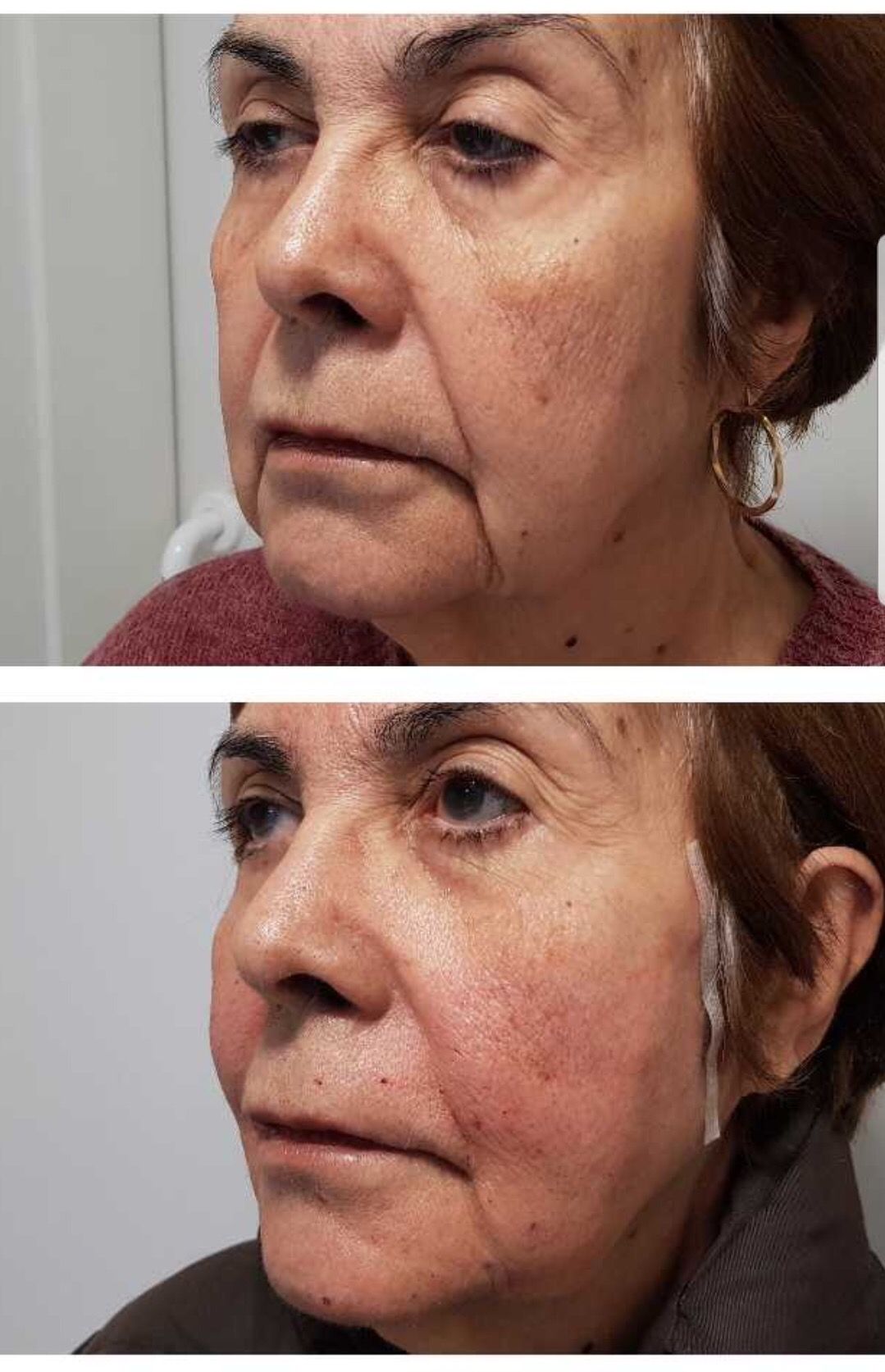 Rosalba Herrero Zerpa-411