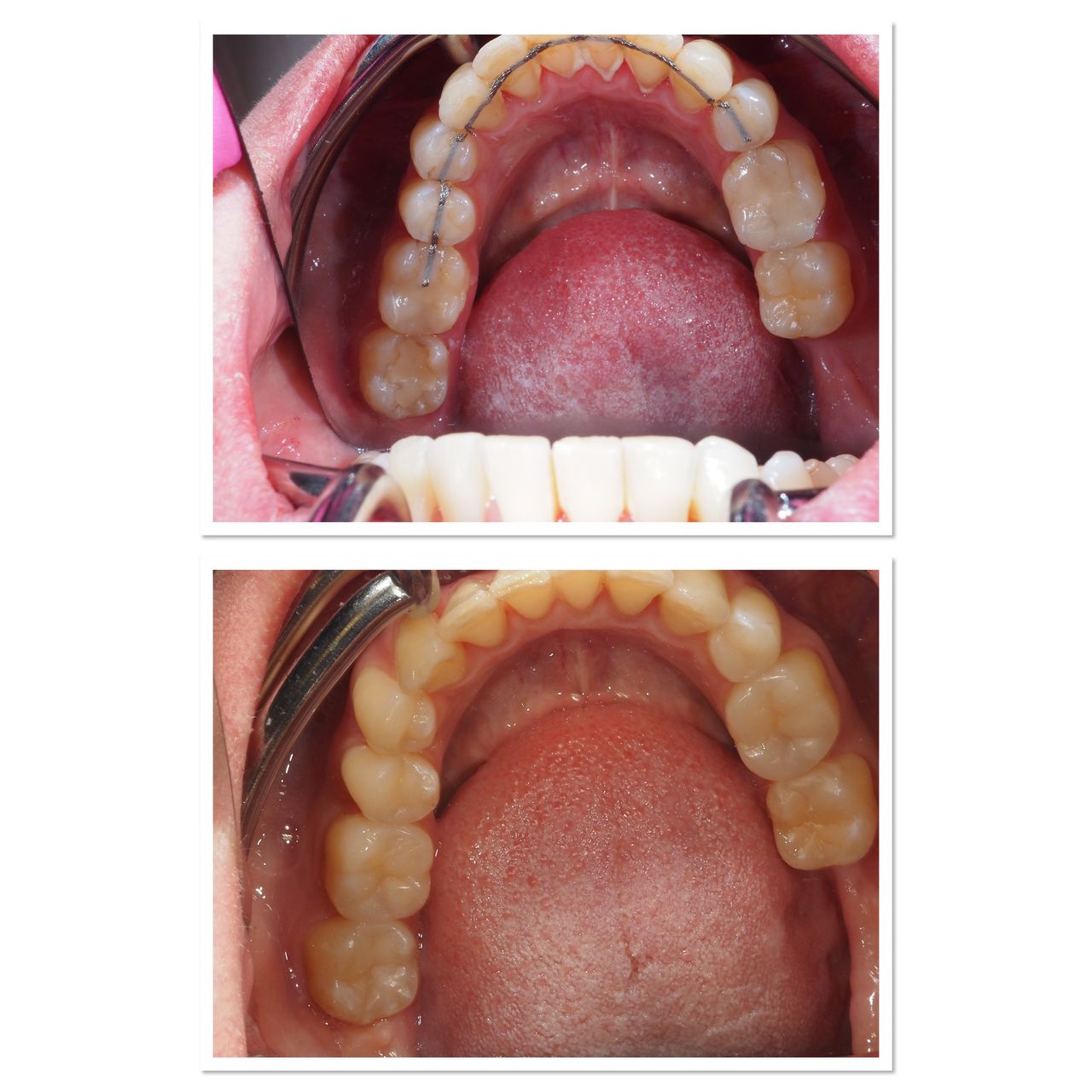 Anna Chmielecka-Borusewicz-6