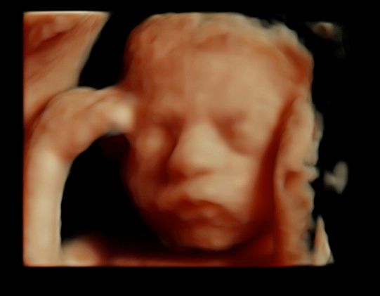 Tommaso Incandela-35