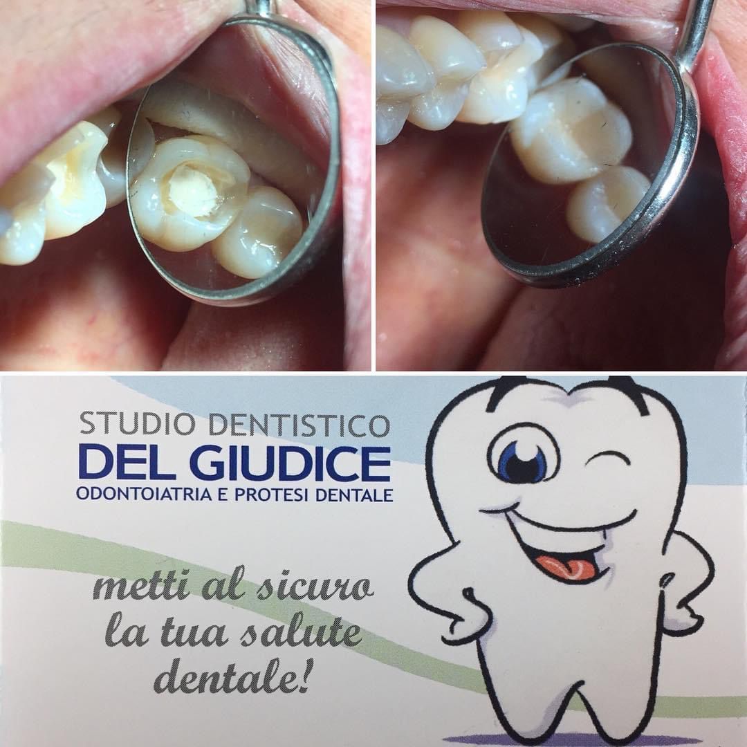 Roberto Del Giudice-5