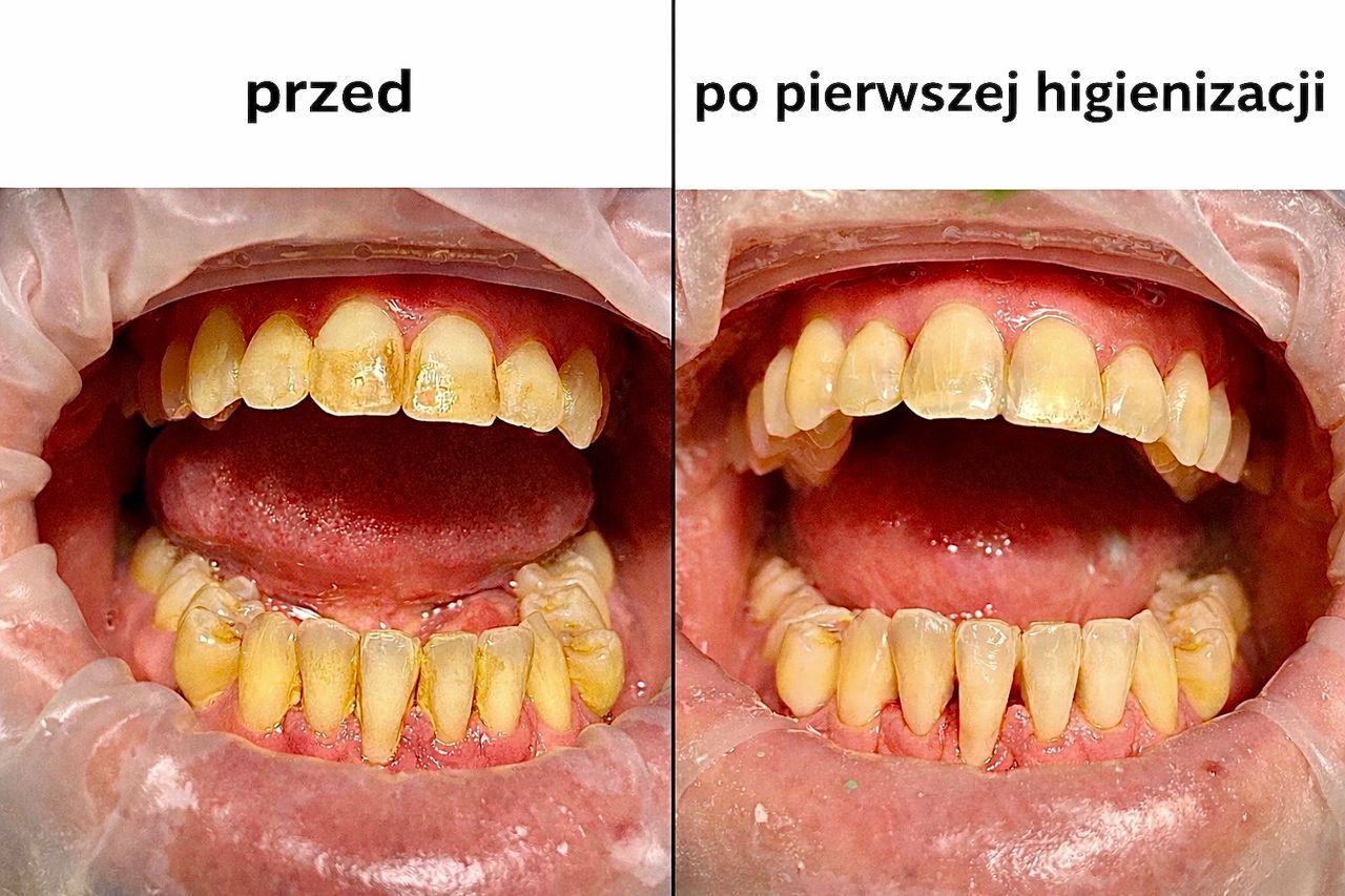 Karolina  Mazurkiewicz -4