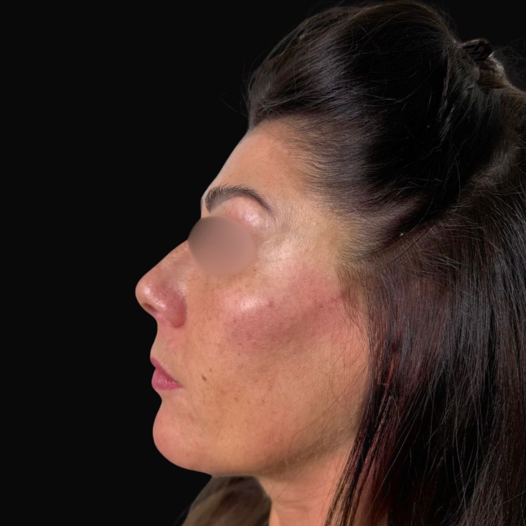 Pierfederico Perazzini-6