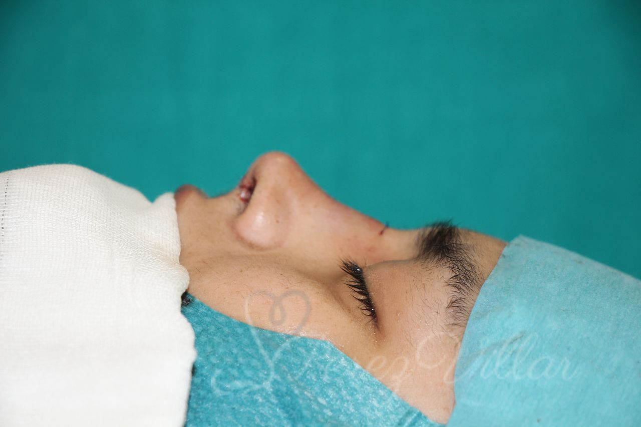 Alvaro Perez Villar-8