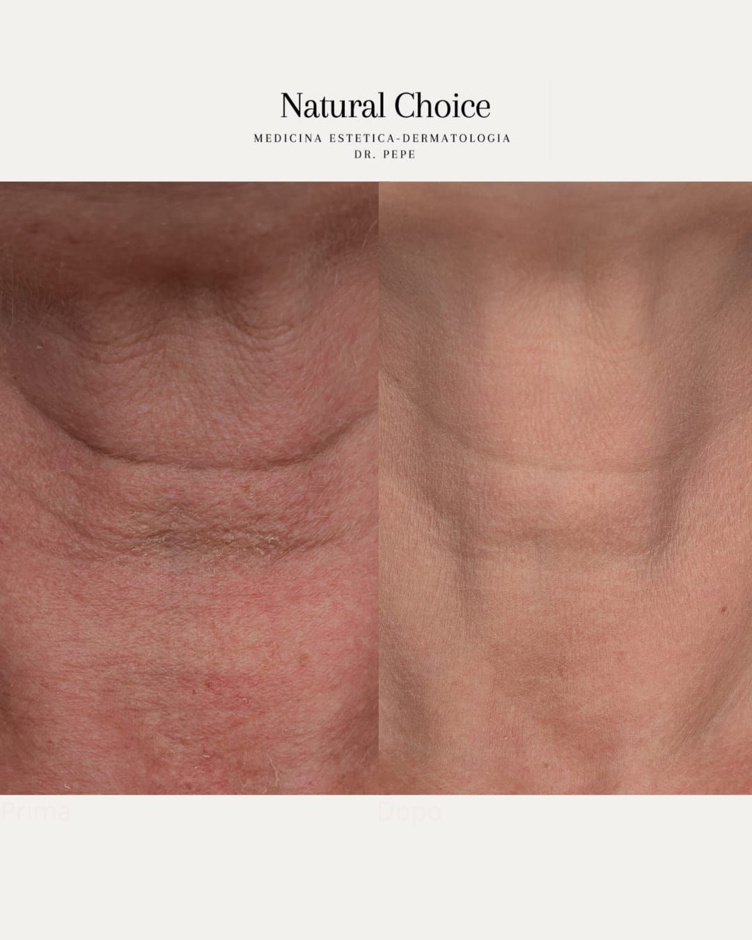 Francesco Maria Pepe-3