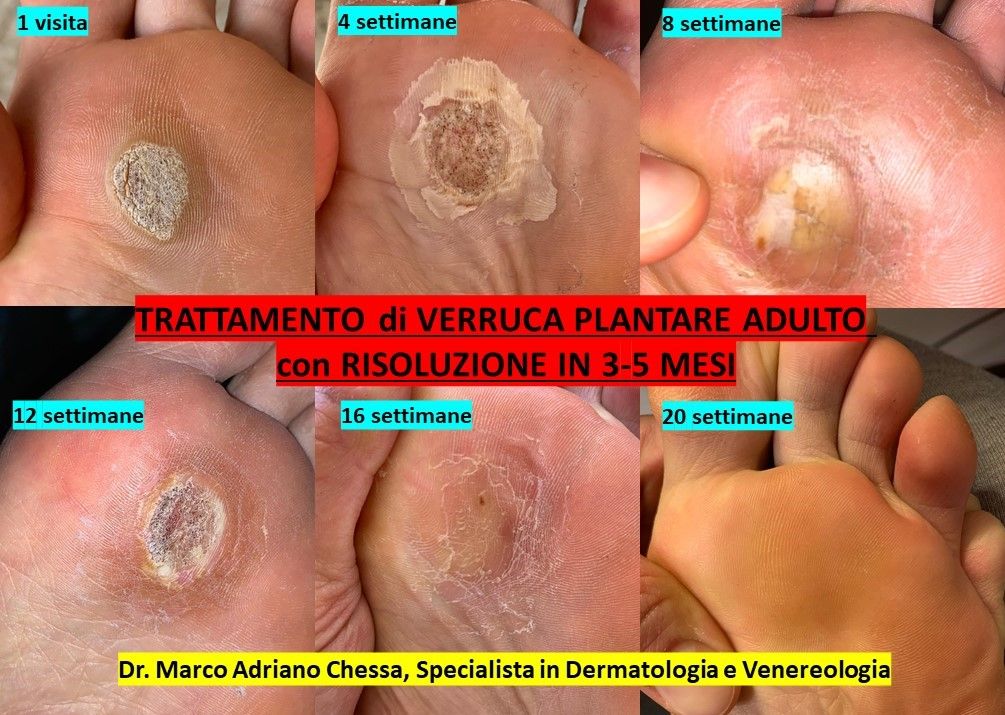 Marco Adriano Chessa-0