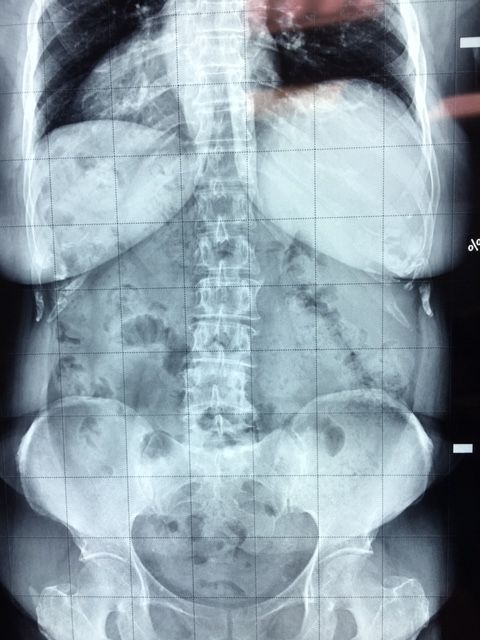 Massimo Brandolin-18