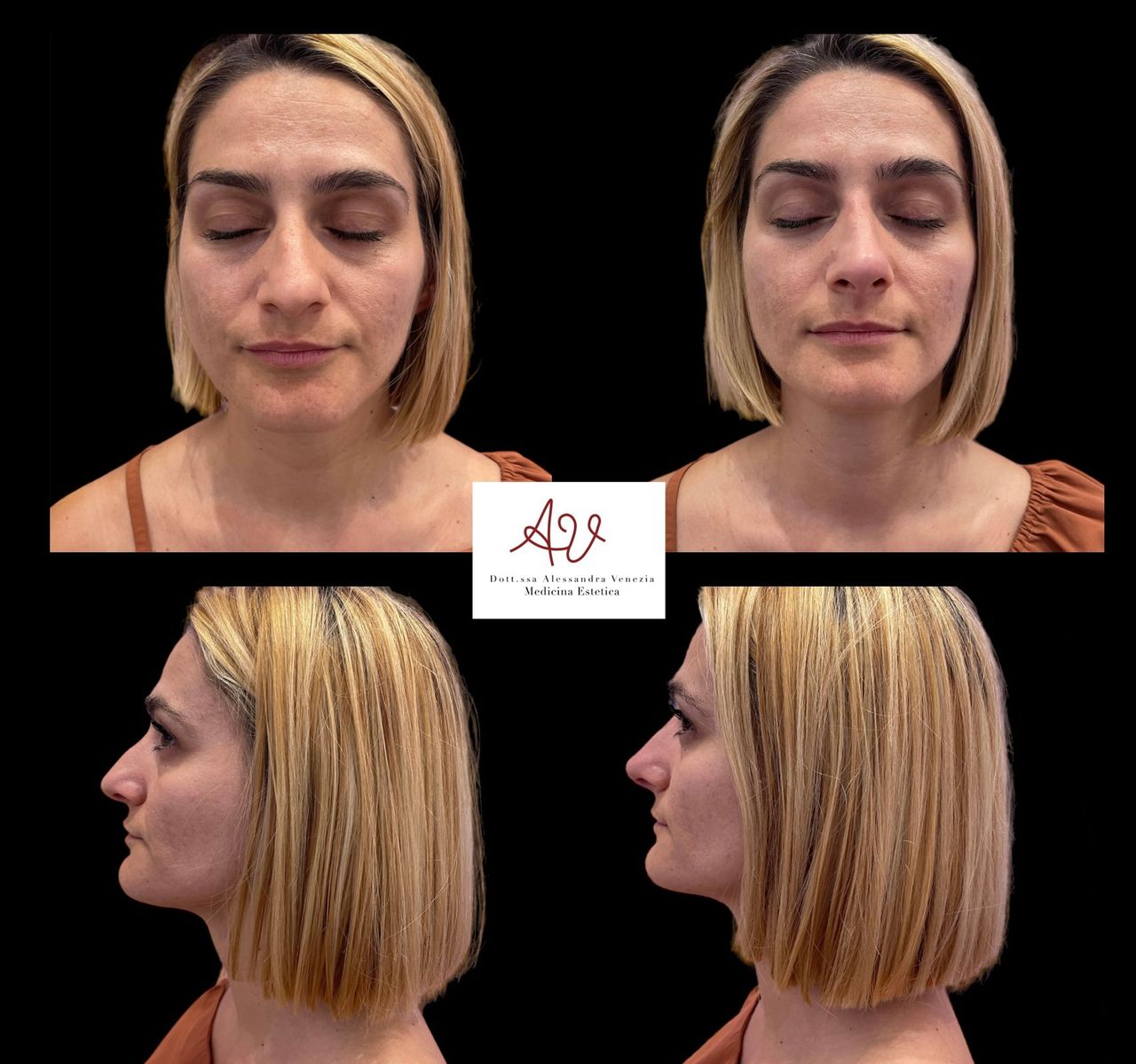 Alessandra Venezia-6