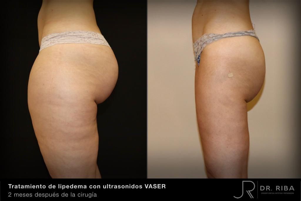 Jordi Riba Vilchez-19