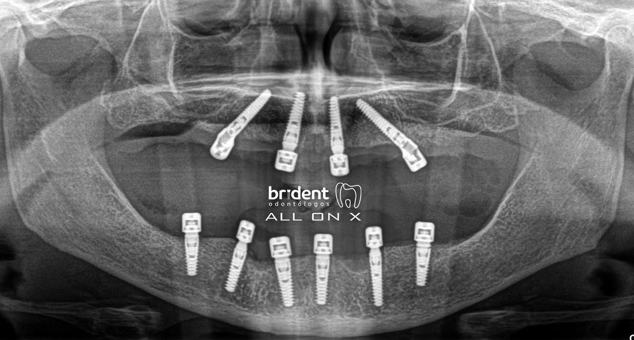 Guillermo Moreno Masiá-46